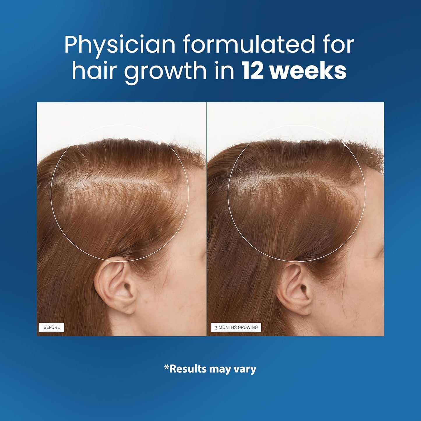 Buy 1 Get 1 Free - Organix™ - Hair Growth Roll-On Serum