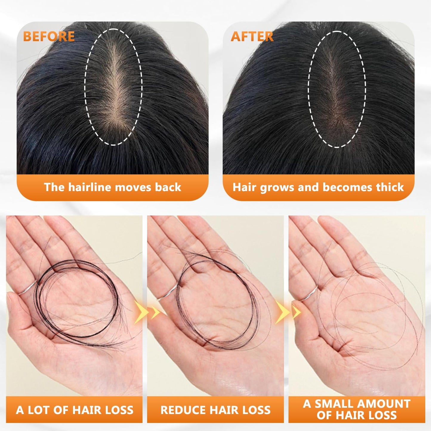 Buy 1 Get 1 Free - Organix™ - Korean Anti-Hair Fall Shampoo
