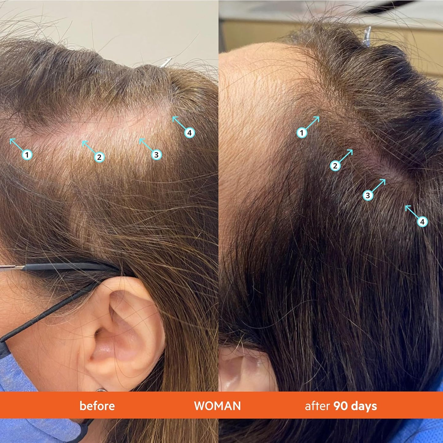 Buy 1 Get 1 Free - Organix™ - Thinning Hair Shampoo