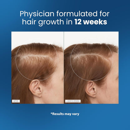 Buy 1 Get 1 Free - Organix™ - Hair Growth Roll-On Serum