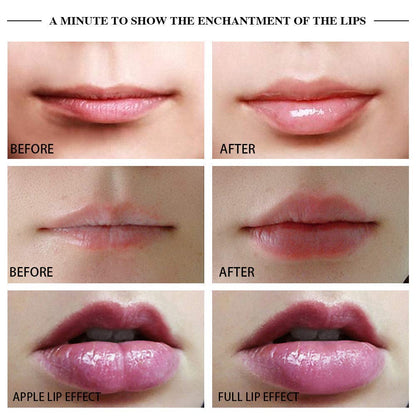 SoftestSofa™ - Lip Plumper