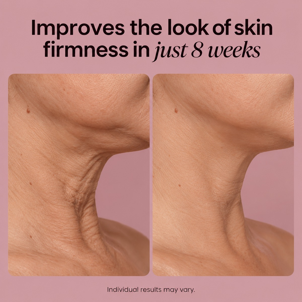 Organix™ - Tighten & Lift Neck & Chest Moisturizer Cream