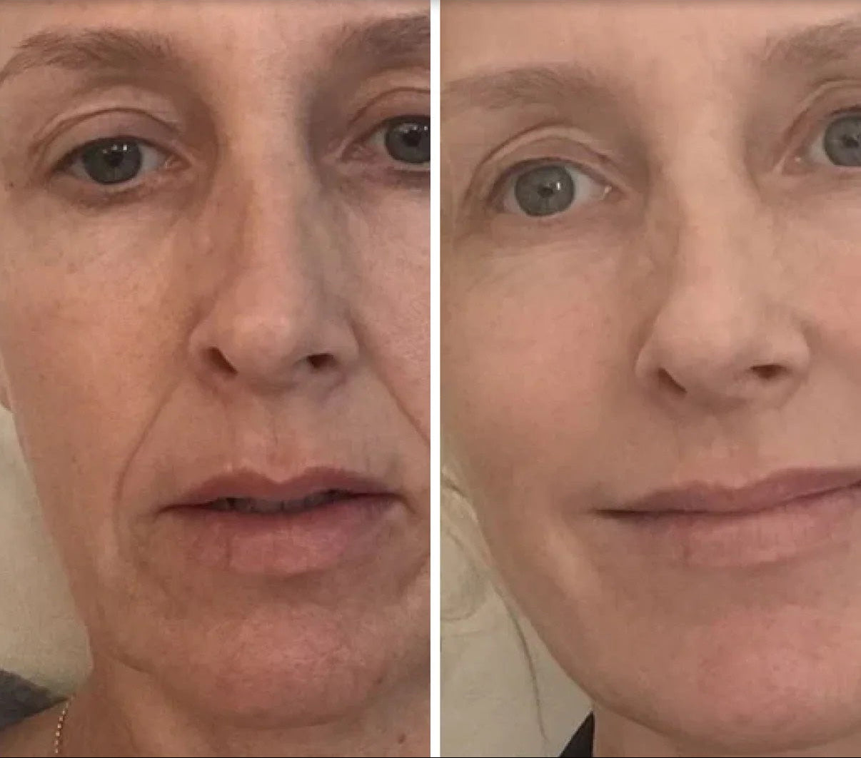 Organix™ - Deep Face Mask