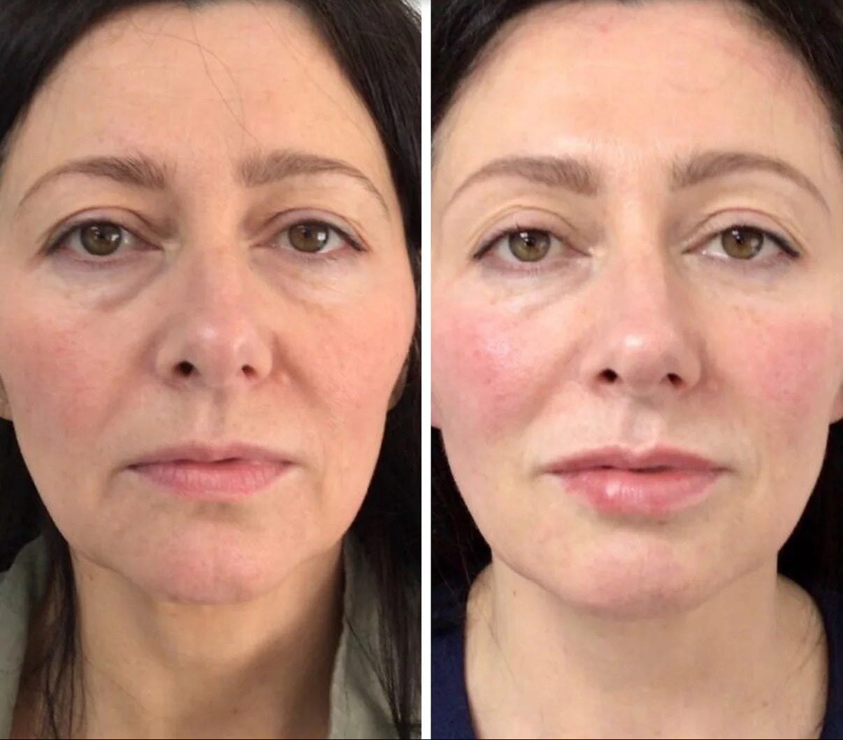 Organix™ - Deep Face Mask