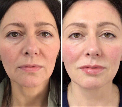 Organix™ - Deep Face Mask