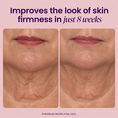 Organix™ - Tighten & Lift Neck & Chest Moisturizer Cream