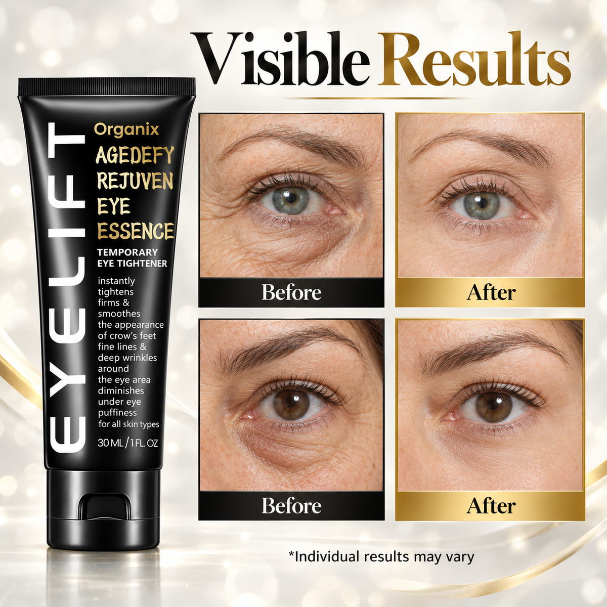 Organix™ - Instant Puffy Under Eye Bag Remover Cream