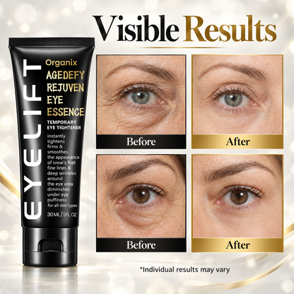 Organix™ - Instant Puffy Under Eye Bag Remover Cream