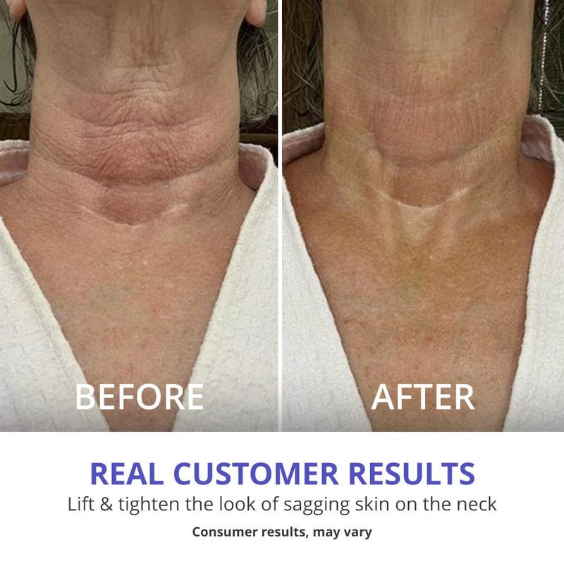 UGlow - Tighten & Lift Neck Cream (Buy 1 Get 1 Free)