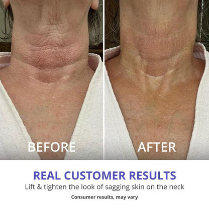 UGlow - Tighten & Lift Neck Cream